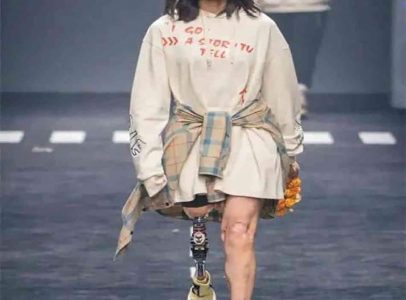 “نيو يو”.. عارضة أزياء صينية من ذوي الإعاقة